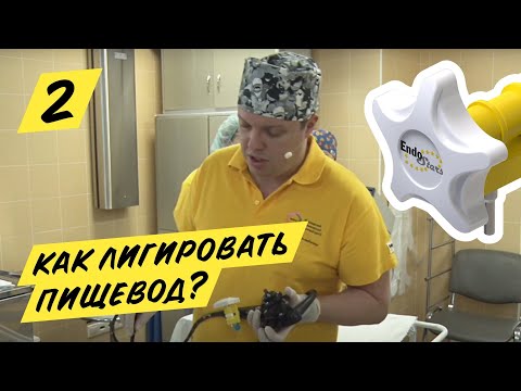 Видео: Эндоскопическое лигирование ВРВП, клинический случай №2, МКНЦ 23.01.19