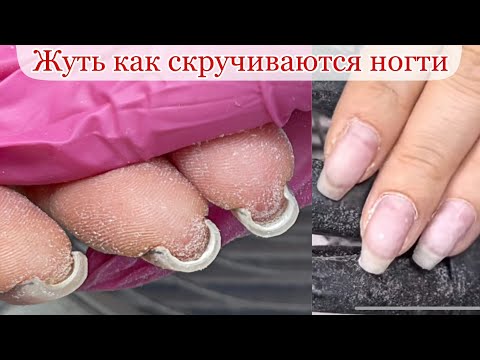 Видео: Жуть как скручиваются ногти/как исправить?