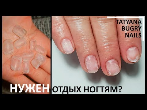Видео: Нужно ли Ногтям Давать ОТДЫХ /Зачем снимать Гель Лак/ Татьяна Бугрий