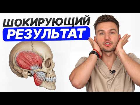 Видео: 1 УПРАЖНЕНИЕ для челюсти 3 МИНУТЫ в день = УПРУГОЕ ЛИЦО / Как быстро подтянуть овал лица?