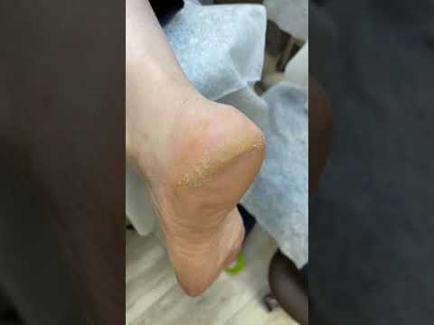 Видео: Педикюр от инструктора РомановаСкул