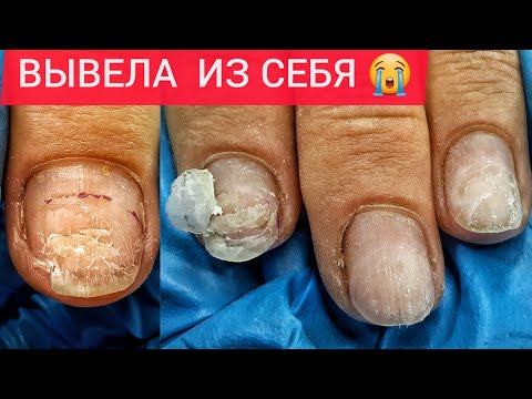 Видео: ДЕЛАЙ КАК Я СКАЗАЛА😡ХОЧУ ТОЛЩЕ И ДРУГОЙ ЦВЕТ🙄🤯НОГТЯМ 2 МЕСЯЦА