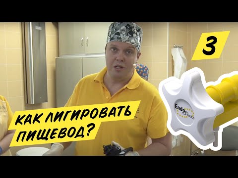 Видео: Эндоскопическое лигирование ВРВП, клинический случай №7, МКНЦ 23.01.19