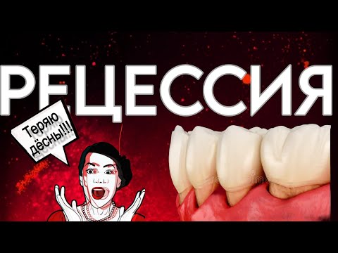 Видео: Как я остановила рецессию у 1000 человек. Почему? Что делать? Как остановить? Подробная инструкция.