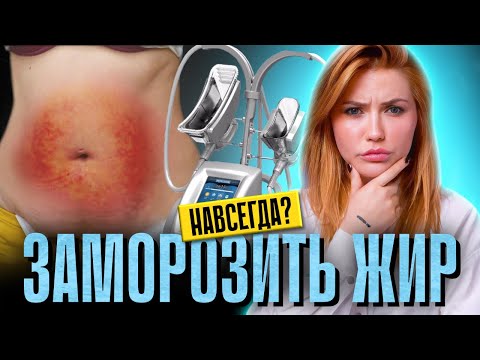 Видео: ПОХУДЕНИЕ ХОЛОДОМ | Чем опасен криолиполиз?