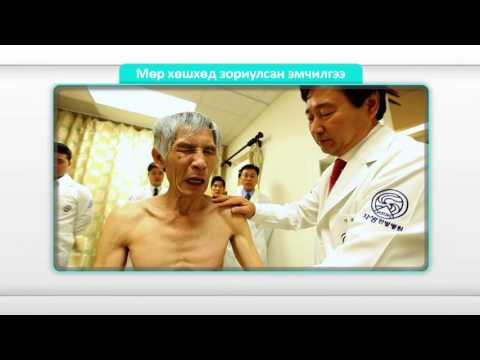 Видео: "Часэн эмнэлэг" Мөрний үе мөчний үрэвслийн эмчилгээ