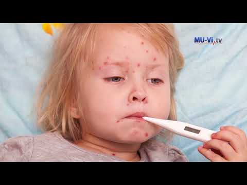 Видео: Какво представлява шарката?