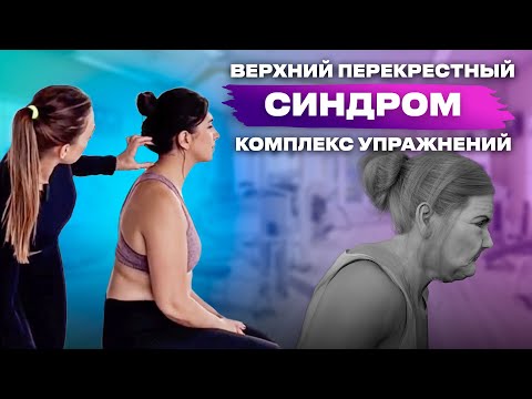 Видео: Верхний перекрёстный синдром: комплекс упражнений для сбалансирования мышц