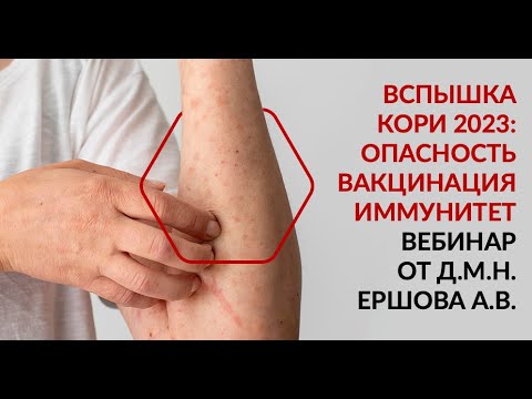 Видео: Вспышка кори 2023. Опасность. Вакцинация. Иммунитет. Вебинар от д.м.н. Ершова А.В.