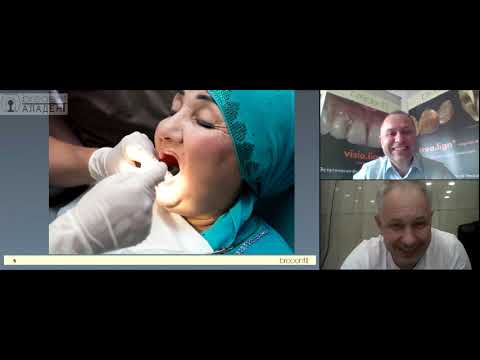 Видео: Вебинар №13 Полное съемное протезирование
