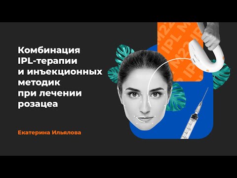 Видео: Комбинация IPL-терапии и инъекционных методик для лечения розацеа