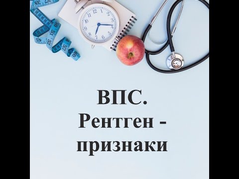 Видео: Классические визуализирующие признаки врожденных сердечно-сосудистых аномалий.Усманова У.У. 21.12.21