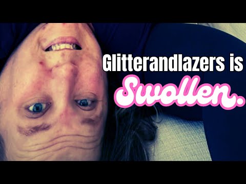 Видео: Glitterandlazers раздулся | Реакция