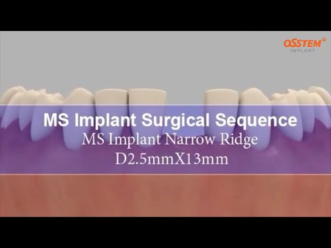 Видео: MS KIT.  Протокол сверления