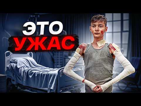 Видео: ЖИЗНЬ БЕЗ КОЖИ / жуткая история одного парня