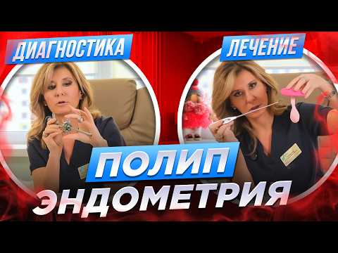 Видео: Как избавиться от полипа эндометрия в матке? Все о возможных методах диагностики и лечения.