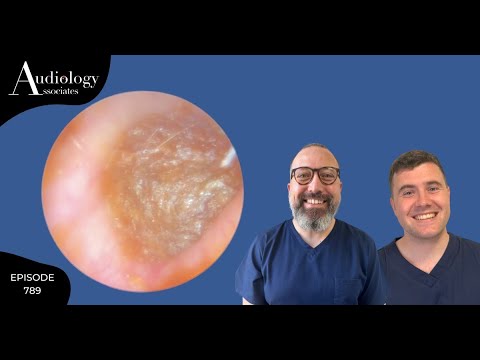 Видео: ЭПИЧЕСКИЙ ПИЛИНГ КОЖИ И УДАЛЕНИЕ УШНОЙ СЕРЫ - EP789