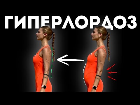Видео: Убери ГИПЕРЛОРДОЗ с помощью ЭТИХ упражнений