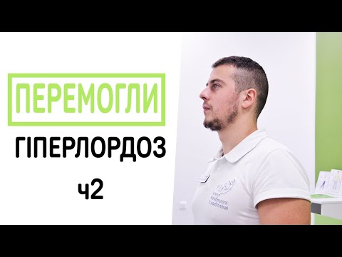 Видео: Як перемогти поперековий лордоз - вправи 2
