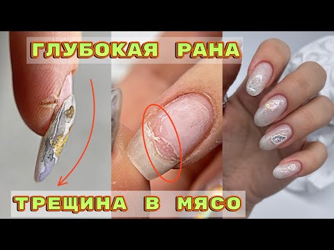 Видео: Трещина в мясо 😱 Клюющий ноготь / Маникюр на себе / Объемный дизайн ногтей