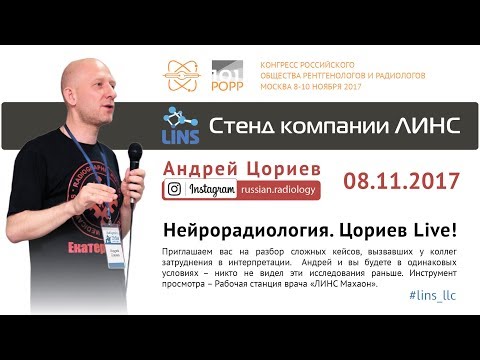 Видео: Андрей  Цориев. Нейрорадиология: Цориев Live!