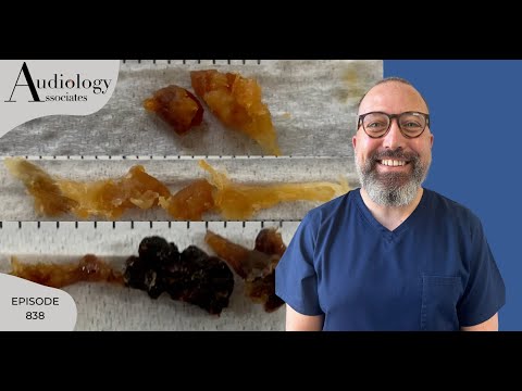 Видео: 3 ОЧЕНЬ РАЗНЫХ МЕТОДА УДАЛЕНИЯ КЕРАТИНА ИЗ УШЕЙ - EP838