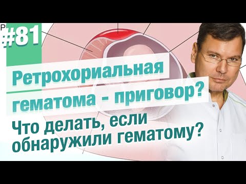Видео: Ретрохориальная гематома на 8 неделе: Можно ли сохранить беременность?