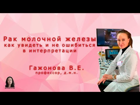 Видео: Рак молочной железы как увидеть и не ошибиться в интерпретации. Профессор Гажонова В.Е.