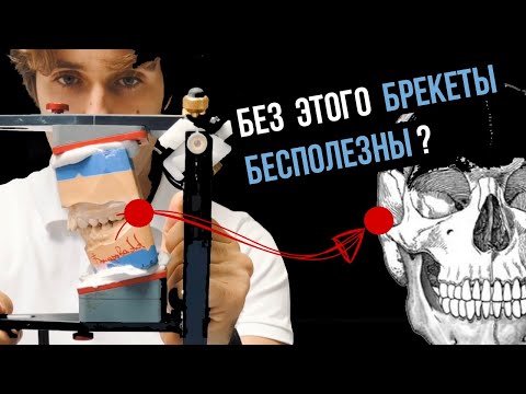 Видео: Лечение на брекетах = правильное положение челюсти?