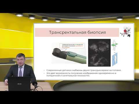 Видео: Биопсия предстательной железы