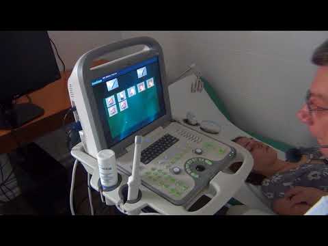 Видео: Право-/лево- ориентация на ультразвуковом сканере