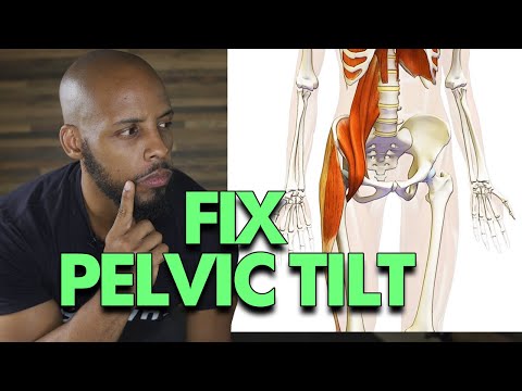 Видео: То, как вы ходите, может исправить передний и задний наклон таза