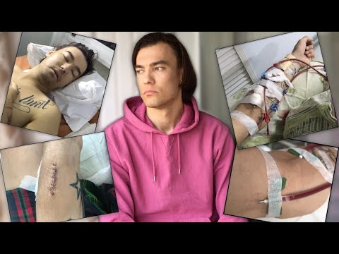 Видео: ОТКАЗАЛИ ПОЧКИ|ТРАНСПЛАНТАЦИЯ|МОЯ ИСТОРИЯ|ПЕРВЫЙ ГЕМОДИАЛИЗ