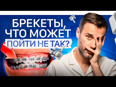 Видео: Самые распространенные жалобы после брекетов — возможные последствия. Что делать?
