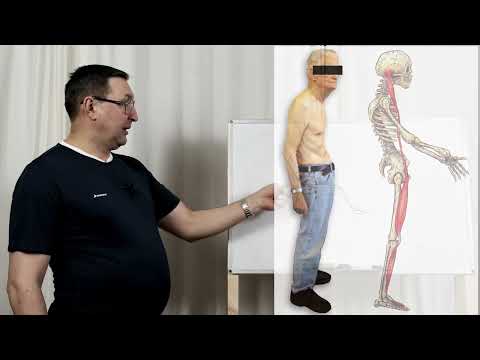 Видео: Как правильно сидеть. Наклон таза назад.