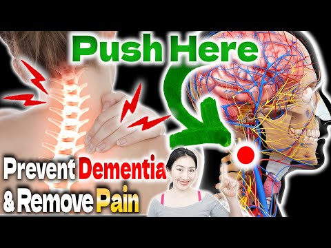 Видео: Нажмите здесь, чтобы слить спинномозговую жидкость и облегчить боль в плече и шее!