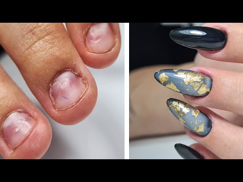 Видео: ❤ ПЕРЕПИЛЕННЫЕ ногти ❤ ПРЕОБРАЖЕНИЕ ❤ СТИЛЬНЫЙ маникюр с ЗОЛОТОМ ❤