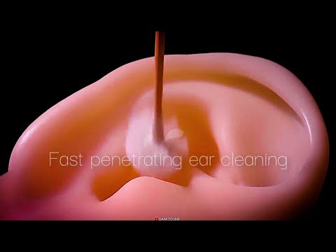 Видео: ASMR  Глубокая чистка ушей, которая всегда вызывает покалывание, которое никогда не перестает❤️