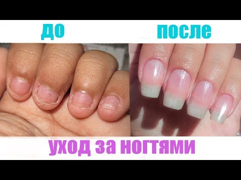 Видео: Как ОТРАСТИТЬ ногти за 3 ДНЯ | УХОД за ногтями // УКРЕПЛЕНИЕ ногтей #WithMe #StayHome