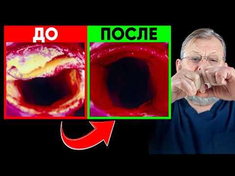 Видео: 3 упражнения для идеальных сосудов