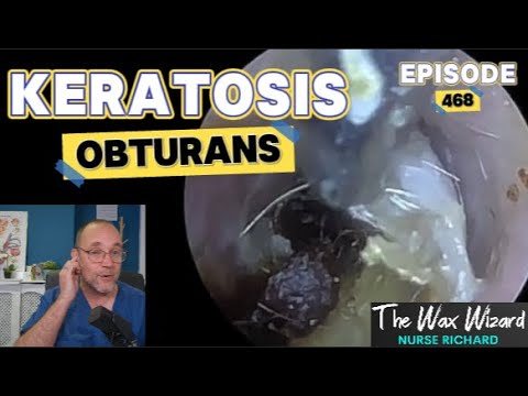 Видео: Обтурирующий кератоз! Эпизод 468
