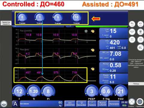 Видео: Симулятор АВЕНТА А/С-CMV вдохи Asiist и Control (Л.№6) Горячев А.С.