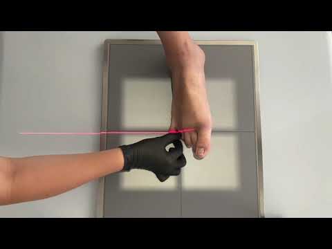 Видео: Укладка пальцев стопы