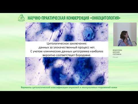 Видео: Варианты цитологической классификации опухолей и неопухолевых поражений кожи