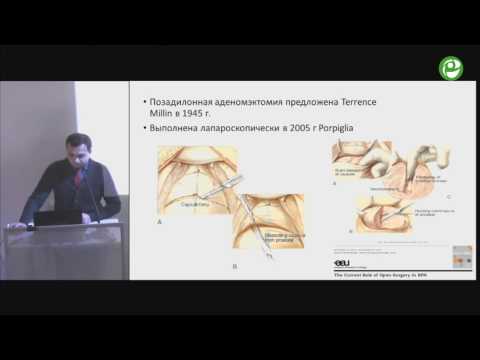 Видео: Сорокин Н И - Основы трансуретральной энуклеации простаты