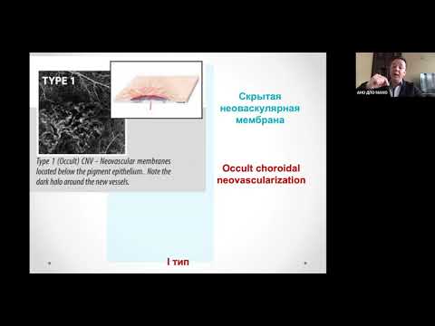 Видео: Дифференцированный подход к лечению пациентов с ВМД