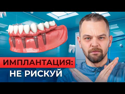 Видео: Импланты: кому нельзя и почему?