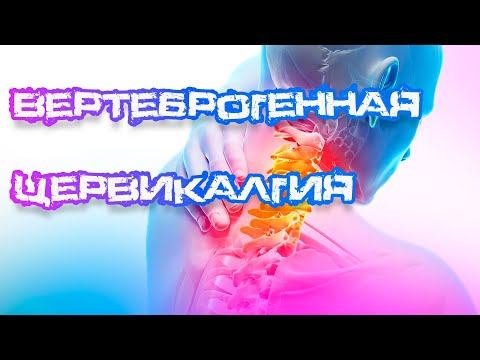 Видео: Вертеброгенная цервикалгия: причины, симптомы и лечение | Советы от доктора Белозёровой М.А.
