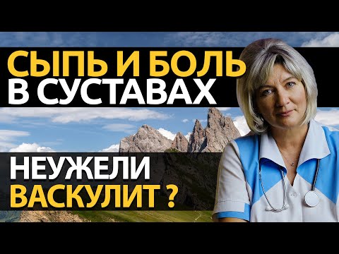 Видео: Боль в суставах и сыпь на коже, чем опасно? А может быть это - васкулит?