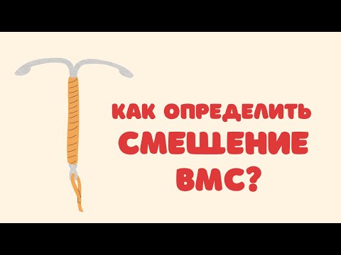 Видео: Как определить смещение ВМС/Як визначити зміщення ВМС @DrOlenaB